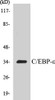 Epigenetics and Nuclear Signaling C/EBP-epsilon Colorimetric Cell-Based ELISA Kit