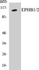 Cell Biology EPHB1/2 Colorimetric Cell-Based ELISA Kit