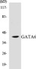 Epigenetics and Nuclear Signaling GATA6 Colorimetric Cell-Based ELISA Kit
