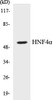 Cell Biology HNF4alpha Colorimetric Cell-Based ELISA Kit