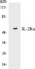 Immunology IL-2Ralpha Colorimetric Cell-Based ELISA Kit