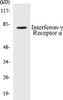 Interferon-gamma Receptor alpha Colorimetric Cell-Based ELISA Kit