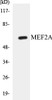 Cell Death MEF2A Colorimetric Cell-Based ELISA Kit