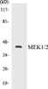 MEK1/2 Colorimetric Cell-Based ELISA Kit