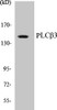 Metabolism PLCbeta3 Colorimetric Cell-Based ELISA Kit