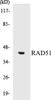 Epigenetics and Nuclear Signaling RAD51 Colorimetric Cell-Based ELISA Kit