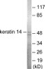Keratin 14 Colorimetric Cell-Based ELISA