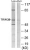 Immunology TRIM38 Colorimetric Cell-Based ELISA
