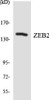 Epigenetics and Nuclear Signaling ZEB2 Colorimetric Cell-Based ELISA