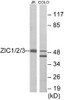Developmental Biology ZIC1/2/3 Colorimetric Cell-Based ELISA