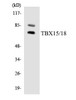 Epigenetics and Nuclear Signaling TBX15/18 Colorimetric Cell-Based ELISA