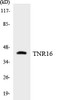 Cell Death TNR16 Colorimetric Cell-Based ELISA