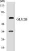 GLU2B Colorimetric Cell-Based ELISA