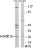 Epigenetics and Nuclear Signaling HOXD12 Colorimetric Cell-Based ELISA