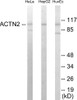 Actinin alpha-2/3 Colorimetric Cell-Based ELISA