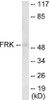 FRK Colorimetric Cell-Based ELISA