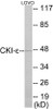Cell Biology CKI-epsilon Colorimetric Cell-Based ELISA
