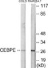 Epigenetics and Nuclear Signaling CEBPD/E Colorimetric Cell-Based ELISA