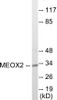 Epigenetics and Nuclear Signaling MEOX2 Colorimetric Cell-Based ELISA