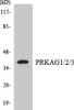 Metabolism PRKAG1/2/3 Colorimetric Cell-Based ELISA