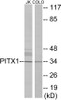 Epigenetics and Nuclear Signaling PITX1 Colorimetric Cell-Based ELISA