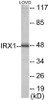 IRX1 Colorimetric Cell-Based ELISA