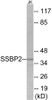 SSBP2 Colorimetric Cell-Based ELISA