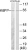 Metabolism K6PP Colorimetric Cell-Based ELISA
