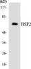 Metabolism HSF2 Colorimetric Cell-Based ELISA