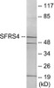 Epigenetics and Nuclear Signaling SFRS4 Colorimetric Cell-Based ELISA