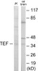 Cell Biology TEF Colorimetric Cell-Based ELISA