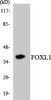 Epigenetics and Nuclear Signaling FOXL1 Colorimetric Cell-Based ELISA