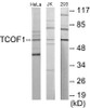 TCOF1 Colorimetric Cell-Based ELISA