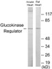 Metabolism Glucokinase Regulator Colorimetric Cell-Based ELISA