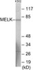 Cell Death MELK Colorimetric Cell-Based ELISA