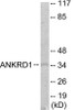 ANKRD1 Colorimetric Cell-Based ELISA