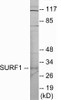 SURF1 Colorimetric Cell-Based ELISA