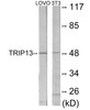 Developmental Biology TRIP13 Colorimetric Cell-Based ELISA