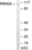 RBM26 Colorimetric Cell-Based ELISA