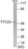 TTC23 Colorimetric Cell-Based ELISA