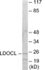 LDOC1L Colorimetric Cell-Based ELISA