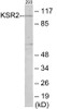 KSR2 Colorimetric Cell-Based ELISA