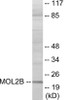 MOBKL2B Colorimetric Cell-Based ELISA