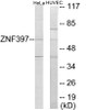 Epigenetics and Nuclear Signaling ZNF397 Colorimetric Cell-Based ELISA