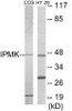 Metabolism IPMK Colorimetric Cell-Based ELISA