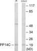 PPP1R14C Colorimetric Cell-Based ELISA