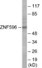 Epigenetics and Nuclear Signaling ZNF596 Colorimetric Cell-Based ELISA