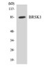 Cell Cycle ELISA Kits BRSK1 Colorimetric Cell-Based ELISA