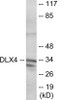 DLX4 Colorimetric Cell-Based ELISA