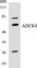 ADCK4 Colorimetric Cell-Based ELISA